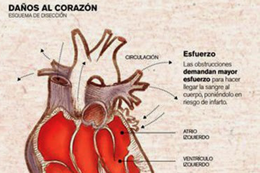 Las infografías de La Nación premiadas en Pamplona